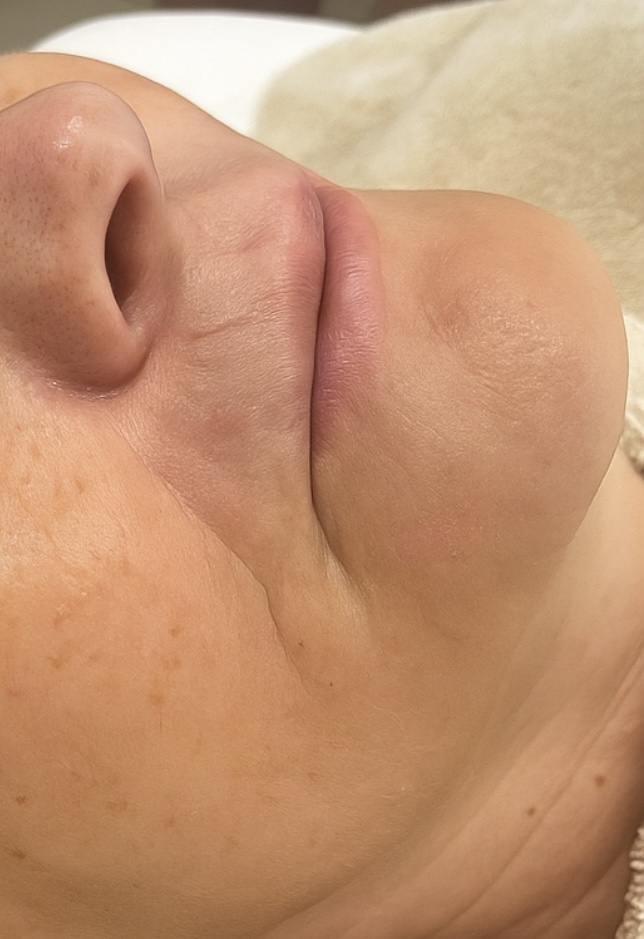 Depilace v obličeji