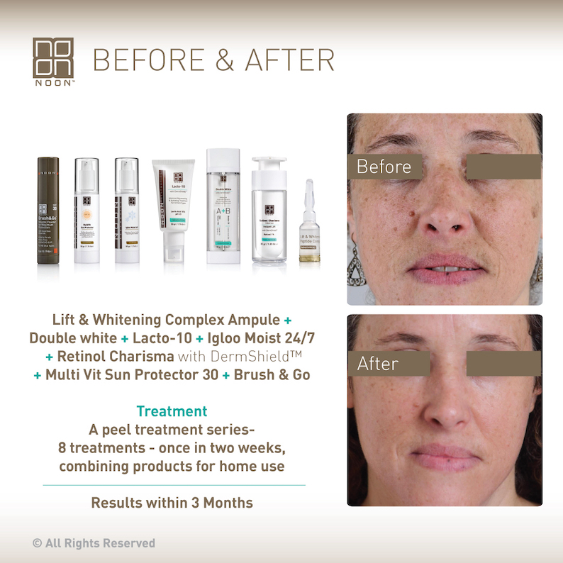 Kosmetické ošetření na pigmentaci